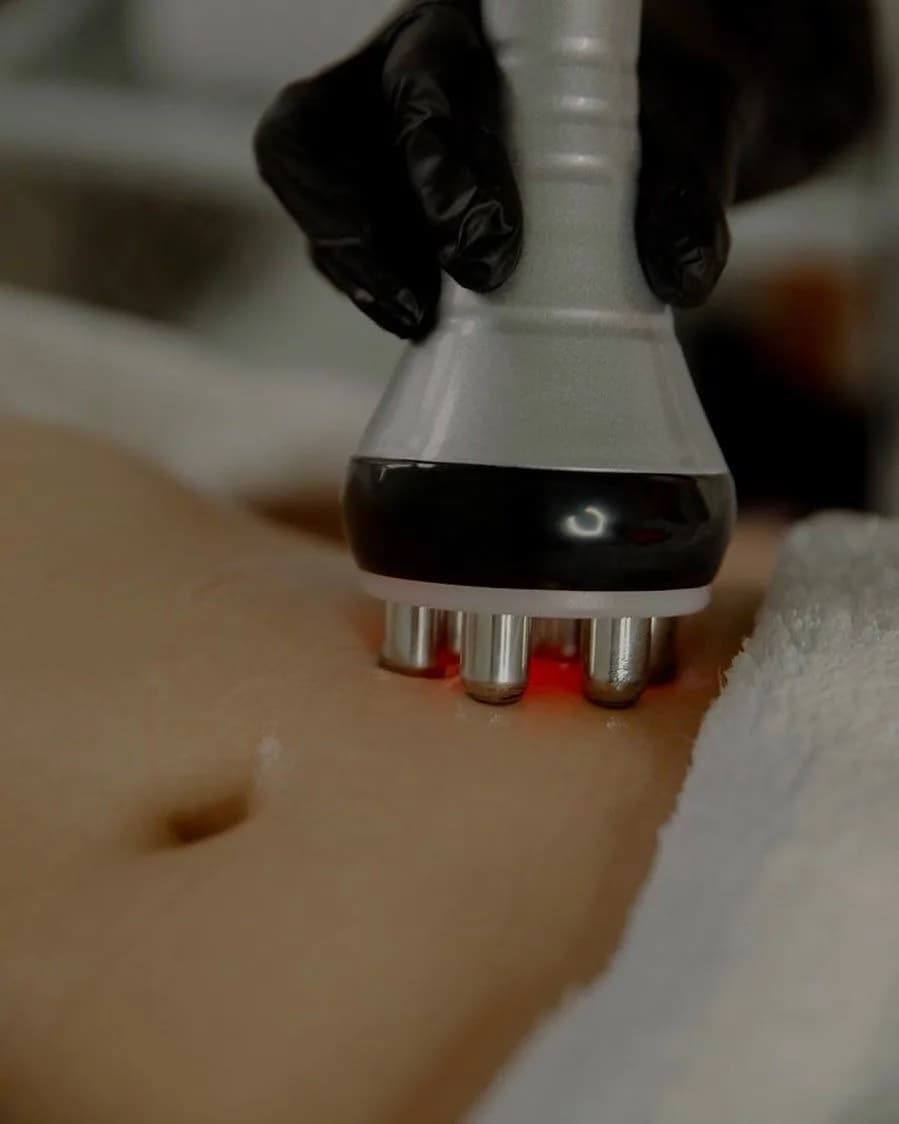 ¿Por qué iniciar un tratamiento corporal?